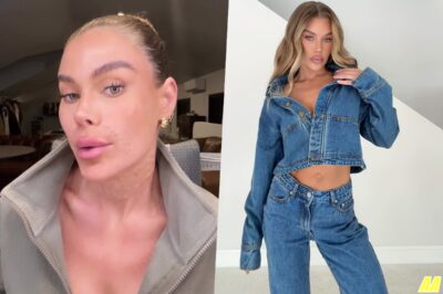 Shocking Transformation: Influencer’s ‘Crazy’ Procedure Leaves Her Covered in Lumps — But She Says It’s Better Than Fillers!