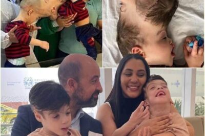 23 Hours, One Historic Surgery: Twin Boys Conjoined at the Head Finally See Each Other for the First Time
