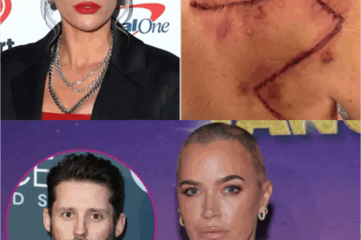 SHOCKING TRAGEDY: Teddi Mellencamp STUNNED by Sudden Death of Brandon Blackstock Amid Her Own Skin Cancer Battle